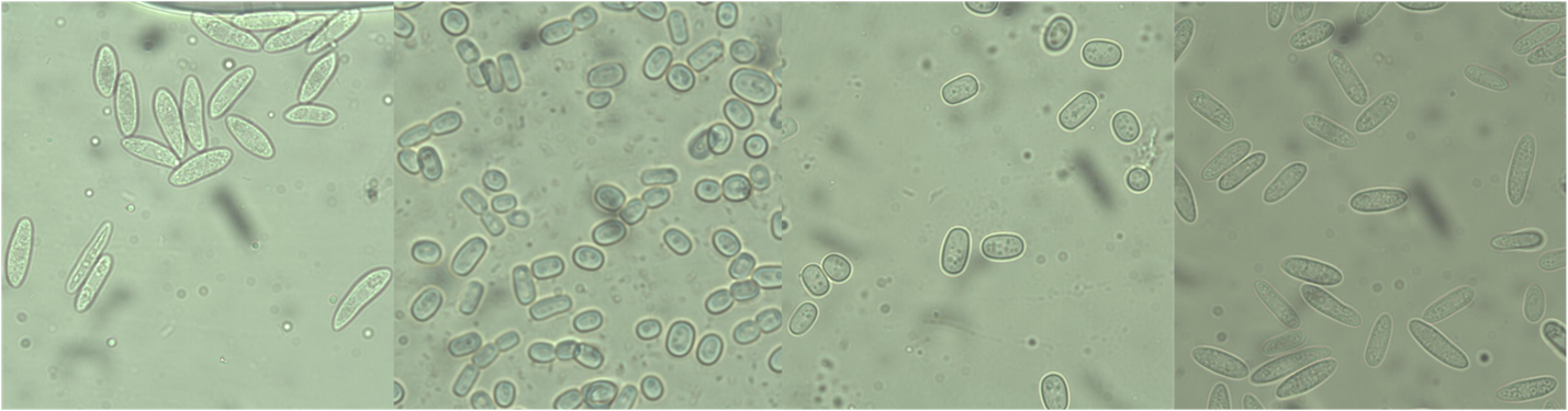 How to recognize and manage anthracnose in olive trees .png